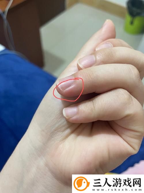 探讨“红肿疼痛小缝不能合拢”的原因与对策
