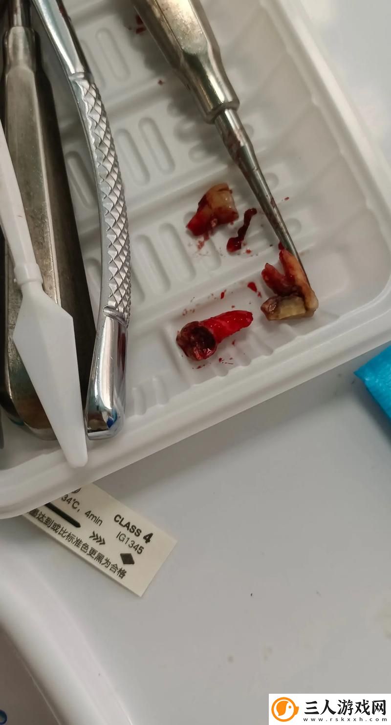 两根一起进去疼***就不疼更新了
