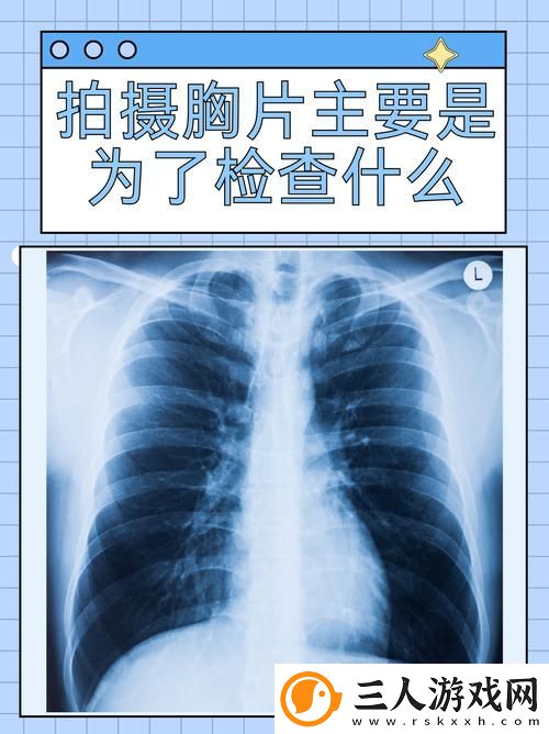 如何通过“全面了解100%胸片曝光率软件”提升放射科诊断的准确性